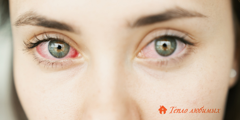 Причини виникнення атеросклерозу сітківки ока